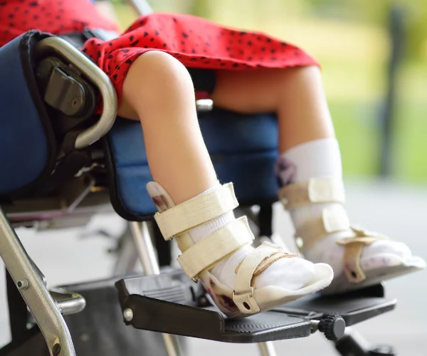 Cerebral Palsy