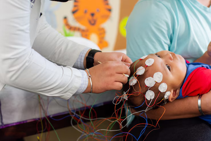 Paediatric Epilepsy