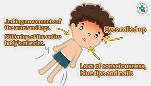 Seizures in Children