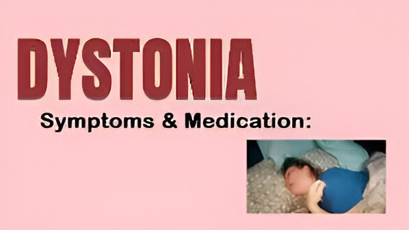 Dystonia in Children
