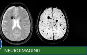 Neuroimaging