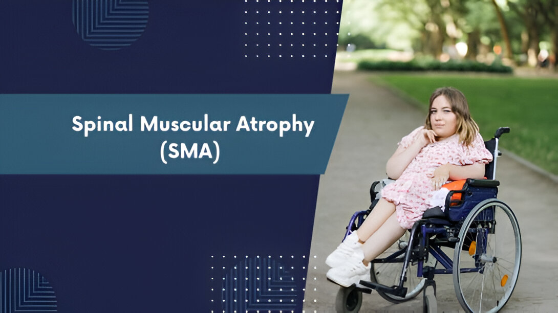 Spinal Muscular Atrophy