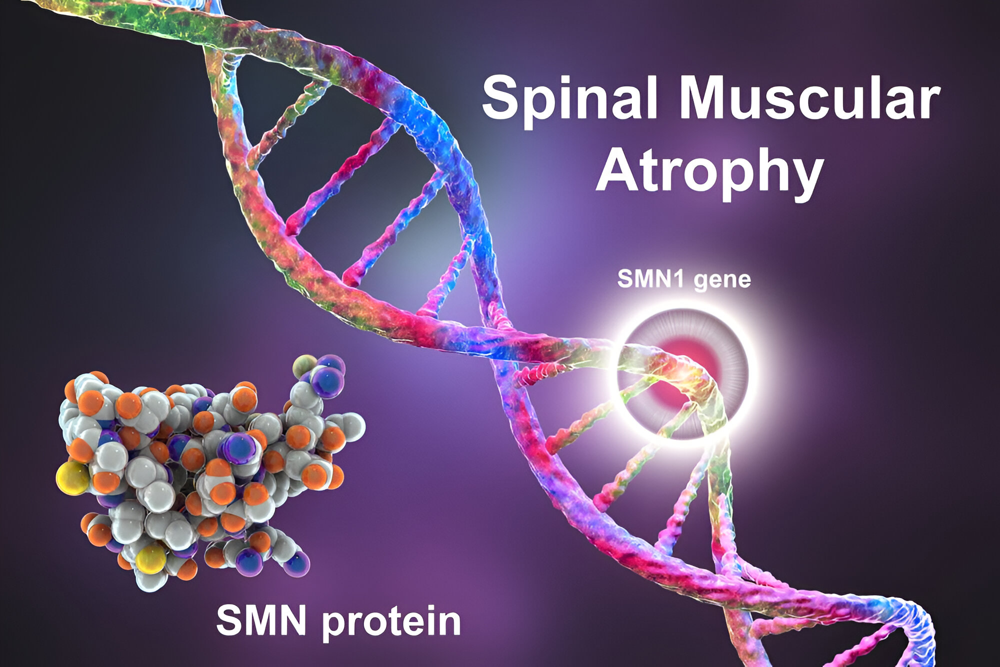SMA Treatment