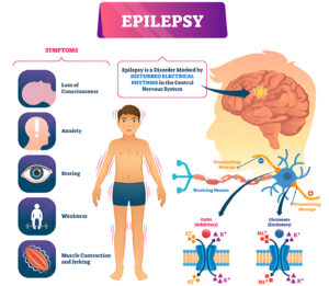 Children With Epilepsy