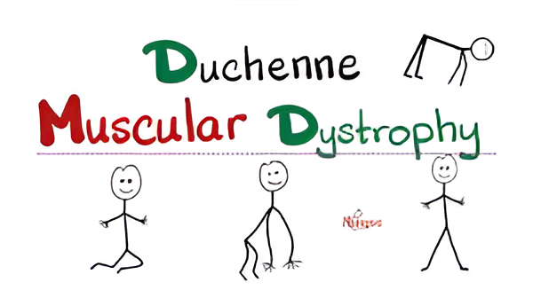 Duchenne Muscular Dystrophy